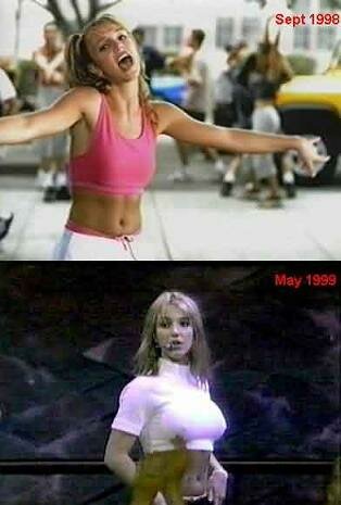 Britney Spears before + After Implants